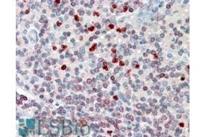 ABIN185717 (3. (ALOX5AP antibody  (Internal Region))