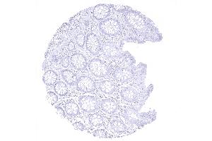 colon descendens mucosa (Recombinant MBP antibody  (AA 150-250))