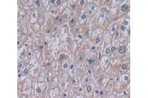 IHC-P analysis of Human Tissue, with DAB staining. (PIGR antibody  (AA 19-120))