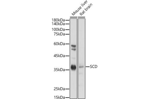 SCD antibody  (C-Term)