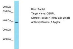 Image no. 1 for anti-Centromere Protein L (CENPL) (AA 121-170) antibody (ABIN6750825) (CENPL antibody  (AA 121-170))