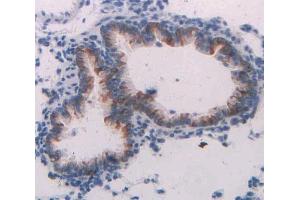 IHC-P analysis of lung tissue, with DAB staining. (Neuregulin 1 antibody  (AA 328-486))