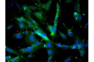 Image provided by One World Lab validation program. (Cathepsin D antibody  (AA 101-200))