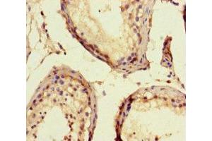 Immunohistochemistry of paraffin-embedded human testis tissue using ABIN7152064 at dilution of 1:100 (ELK1 antibody  (AA 247-403))