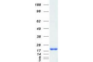 Western Blotting (WB) image for Microseminoprotein, beta (MSMB) protein (Myc-DYKDDDDK Tag) (ABIN2726465)