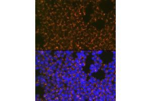 Immunofluorescence analysis of Jurkat cells using CCR8 Rabbit mAb (ABIN1683150, ABIN3018779, ABIN3018780 and ABIN7101661) at dilution of 1:100 (40x lens). (CCR8 antibody)