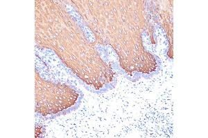 Keratin 6C antibody