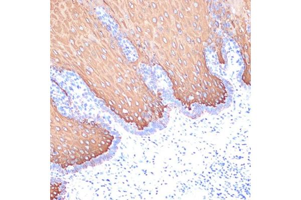 Keratin 6C antibody
