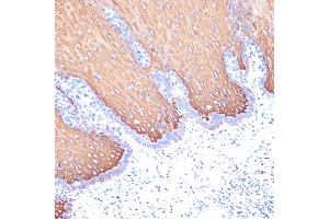 Immunohistochemistry of paraffin-embedded human esophageal using Cytokeratin 6 (KRT6) (KRT6) Rabbit mAb (ABIN7268104) at dilution of 1:100 (40x lens). (Keratin 6C antibody)