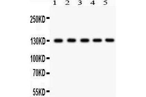 Western Blotting (WB) image for anti-Death-Domain Associated Protein (DAXX) (AA 56-345) antibody (ABIN3043822)