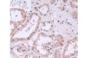 Used in DAB staining on fromalin fixed paraffin- embedded Kidney tissue (PTBP1 antibody  (AA 1-531))