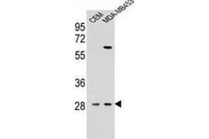 Western blot analysis in CEM,MDA-MB453 cell line lysates (35ug/lane) using Interleukin-12 beta/IL12B  Antibody (C-term).