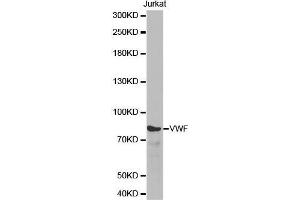 Western blot analysis of extracts of Jurkat cell line, using VWF antibody. (VWF antibody  (AA 50-150))
