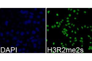 Immunofluorescence analysis of 293T cells using Symmetric DiMethyl-Histone H3-R2 antibody. (Histone 3 antibody  (H3R2me2))