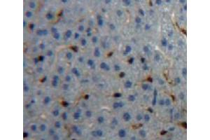 Used in DAB staining on fromalin fixed paraffin-embedded liver tissue (CPB2 antibody  (AA 309-374))