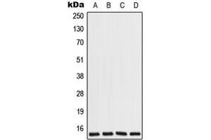 Western blot analysis of COX7A2L expression in Jurkat (A), HeLa (B), Raw264. (COX7A2L antibody  (Center))