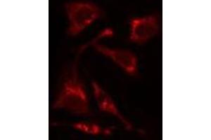 ABIN6275505 staining HuvEc cells by IF/ICC. (RIMKLA antibody  (Internal Region))