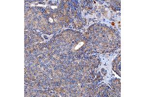 IHC analysis of TTC7B using anti-TTC7B antibody (ABIN7601050). (TTC7B antibody  (AA 275-730))