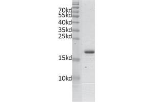 Recombinant BPTF / FALZ (2791-2911) protein gel. (BPTF Protein (AA 2791-2911) (His tag,DYKDDDDK Tag))