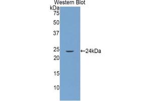 Western blot analysis of the recombinant protein. (GRIP1 antibody  (AA 79-268))