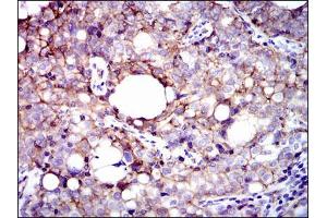 Immunohistochemistry (IHC) image for anti-Integrin beta 1 (ITGB1) antibody (ABIN969531)