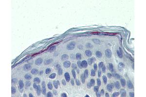 Anti-ERCC8 antibody IHC of human skin. (ERCC8 antibody  (AA 106-300))