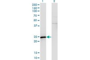 Western Blot analysis of SPA17 expression in transfected 293T cell line by SPA17 monoclonal antibody (M03), clone 3B6.