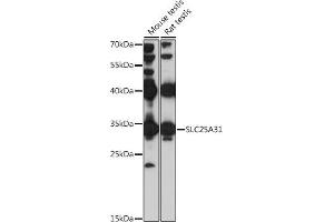 Western blot analysis of extracts of various cell lines, using SLC25 antibody (ABIN7270427) at 1:1000 dilution. (SLC25A31 antibody  (AA 100-200))