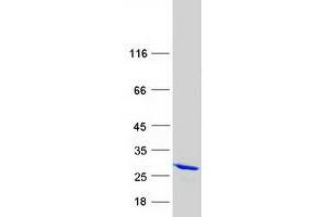 Western Blotting (WB) image for Reticulon 4 (RTN4) (Transcript Variant 3) protein (Myc-DYKDDDDK Tag) (ABIN2730748)