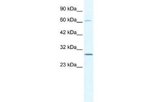 WB Suggested Anti-PAntibody   Titration: 2. (PARP11 antibody  (N-Term))