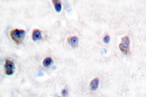 Image no. 2 for anti-Amyloid beta (A4) Precursor Protein (APP) antibody (ABIN265307) (APP antibody)