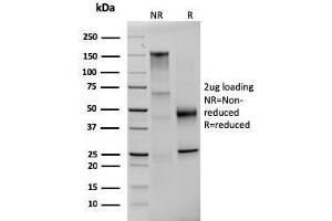 SDS-PAGE Analysis Purified Prolactin Mouse Monoclonal Antibody (PRL/2642). (Prolactin antibody  (AA 63-201))