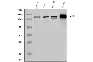 Western blot analysis of NCAM1 using anti-NCAM1 antibody (ABIN7602512). (CD56 antibody  (AA 80-328))