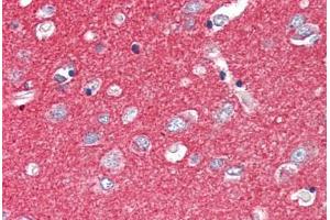 Human Brain, Cortex (formalin-fixed, paraffin-embedded) stained with SNAP25 antibody ABIN337119 at 2. (SNAP25 antibody  (AA 193-206))