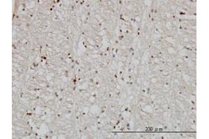 Image no. 1 for anti-DnaJ (Hsp40) Homolog, Subfamily B, Member 2 (DNAJB2) (AA 216-325) antibody (ABIN598751) (DNAJB2 antibody  (AA 216-325))