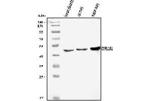 Western blot analysis of CYP11A1 using anti-CYP11A1 antibody (ABIN7602372).
