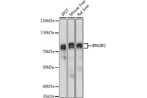 Western blot analysis of extracts of various cell lines, using IFNGR1 antibody (ABIN6127566, ABIN6142197, ABIN6142198 and ABIN6221420) at 1:1000 dilution. (IFNGR1 antibody  (AA 270-489))