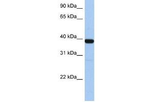 WB Suggested Anti-ZNF781 Antibody Titration:  0.