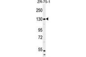 WWC1 Antibody (N-term) western blot analysis in ZR-75-1 cell line lysates (35 µg/lane).