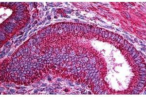 Human Uterus: Formalin-Fixed, Paraffin-Embedded (FFPE) (TRF1 antibody)