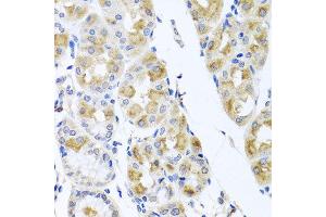 Immunohistochemistry of paraffin-embedded human gastric using TMEM43 antibody at dilution of 1:100 (x40 lens). (TMEM43 antibody)