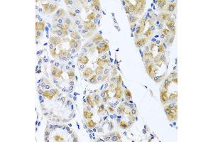 Immunohistochemistry of paraffin-embedded human gastric using TMEM43 antibody at dilution of 1:100 (x40 lens).