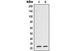 Western blot analysis of TCTP expression in DU145 (A), CCRFCEM (B) whole cell lysates. (TPT1 antibody  (Center))
