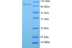 SDS-PAGE (SDS) image for phosphoenolpyruvate Carboxykinase 1 (Soluble) (PCK1) (AA 1-622), (full length) protein (His tag) (ABIN5710071)