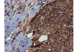 Immunohistochemistry (IHC) image for anti-Complement Component 1, S Subcomponent (C1S) antibody (ABIN1497565) (C1S antibody)