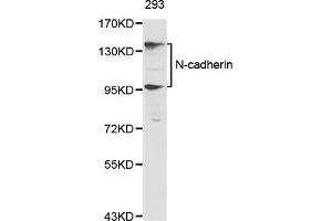 Western Blotting (WB) image for anti-Cadherin 2 (CDH2) (AA 450-550) antibody (ABIN6213846) (N-Cadherin antibody  (AA 450-550))