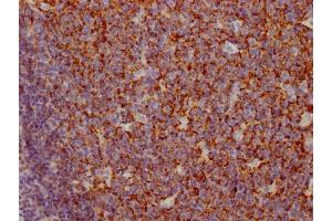 IHC image of ABIN7127401 diluted at 1:100 and staining in paraffin-embedded human tonsil tissue performed on a Leica BondTM system. (Recombinant CD35 antibody)