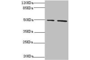 Western blot All lanes: NFS1 antibody at 6. (NFS1 antibody  (AA 208-457))