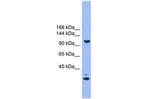Image no. 1 for anti-StAR-Related Lipid Transfer (START) Domain Containing 8 (STARD8) (AA 181-230) antibody (ABIN6746634) (STARD8 antibody  (AA 181-230))