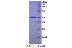 SDS-PAGE (SDS) image for FK506 Binding Protein 10, 65 KDa (FKBP10) (AA 158-440) protein (His tag) (ABIN1878469) (FKBP10 Protein (AA 158-440) (His tag))